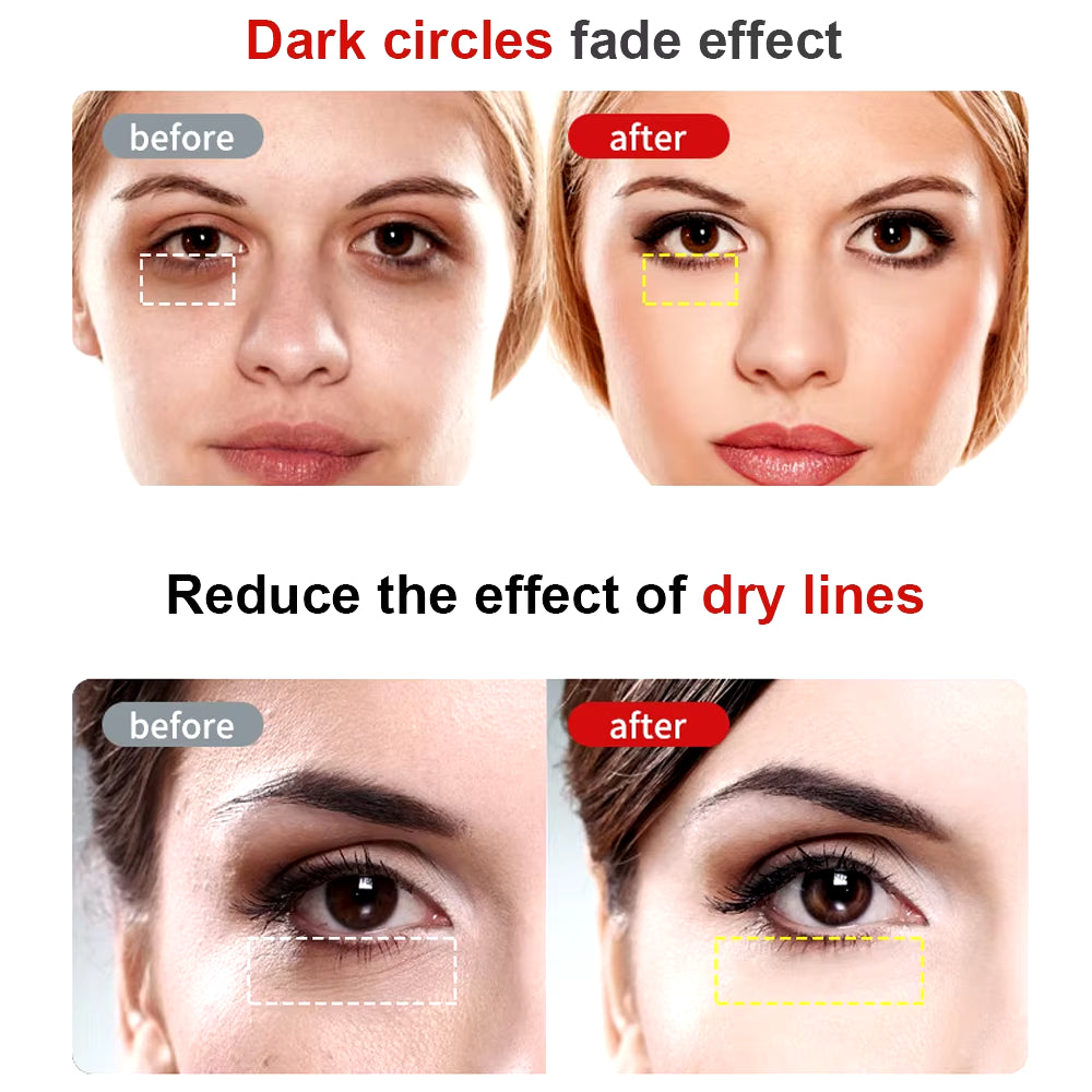 Electric Eye Massager Pen for Dark Circles and Wrinkle Reduction with Vibration and Radio Frequency Technology - Available in 5 Colors