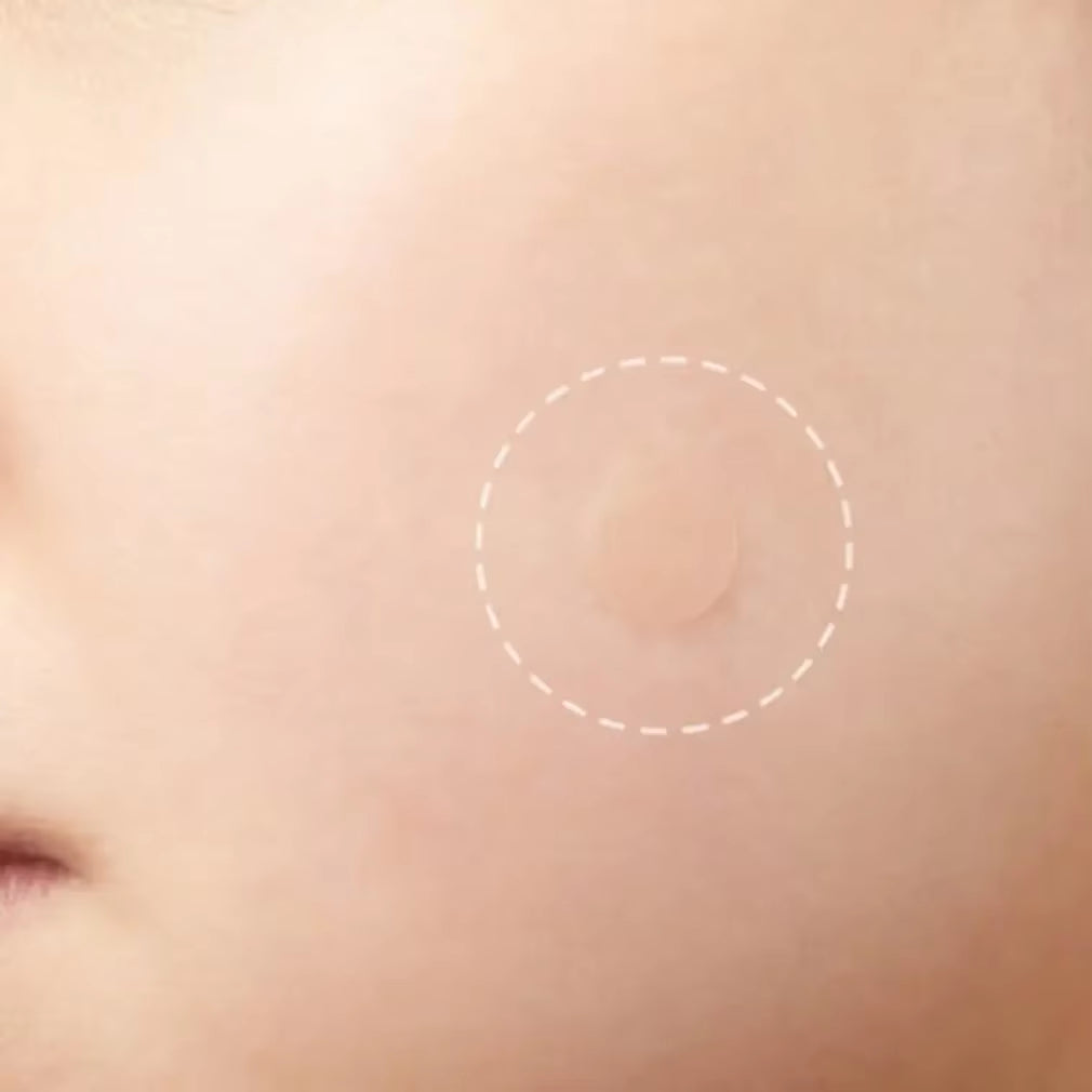 Closed Pimple Master Patch 24 Patches Invisible Absorption Secretions Breathable Makeup Colloidal Mask Skin Beauty Care Stickers